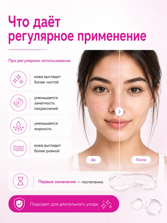 Гель от прыщей, акне и черных точек с азелаиновой кислотой 15% АЗЕЛОДЖИ, 30 г