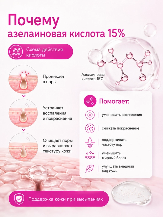 Гель от прыщей, акне и черных точек с азелаиновой кислотой 15% АЗЕЛОДЖИ, 30 г