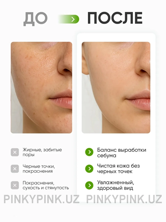 Кислородная пенка для умывания Celimax The Real Noni Acne Bubble Cleanser, 155 мл