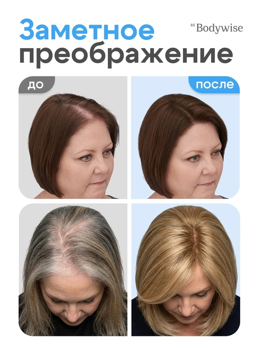 Сыворотка для роста волос Hair Growth Serum Rooll-on Bodywise, 25 мл, от выпадения