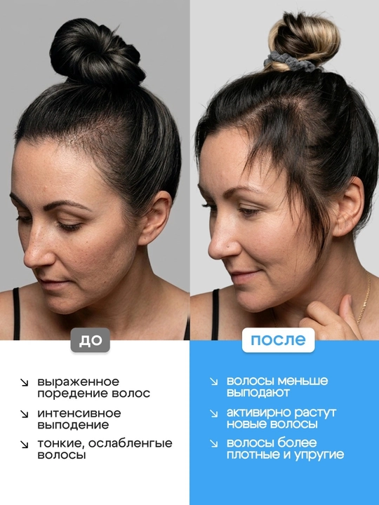 Сыворотка для роста волос Hair Growth Serum Rooll-on Bodywise, 25 мл, от выпадения