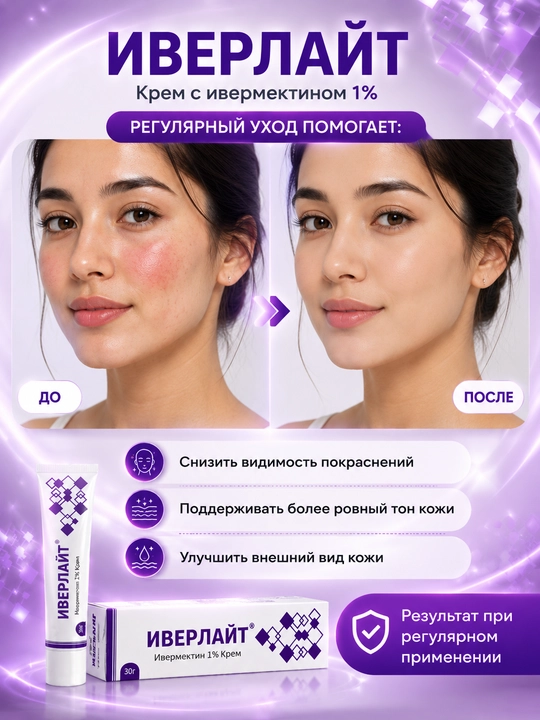 Крем ИВЕРЛАЙТ для ухода за кожей, склонной к покраснениям и розацеа, 30 г