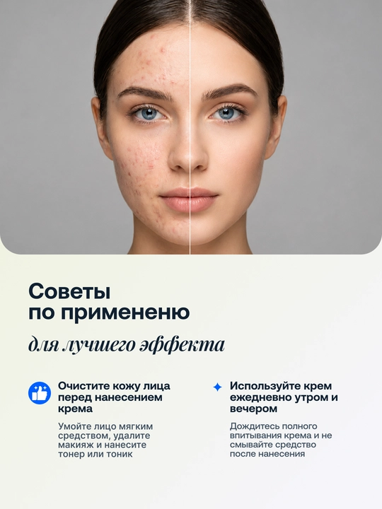 Крем гель для лица от прыщей и акне, с салициловой кислотой и церамидом, 30 г