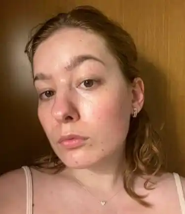Anua Niacinamide 10% + TXA 4% Serum сыворотка для осветления пигментации следов постакне