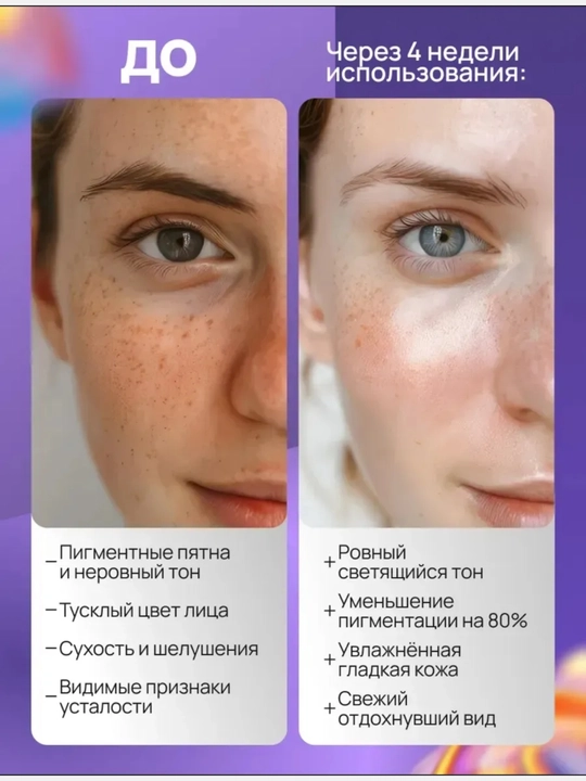 Крем отбеливающий для лица - убирает пигментные пятна, темные круги и веснушки, ровный тон