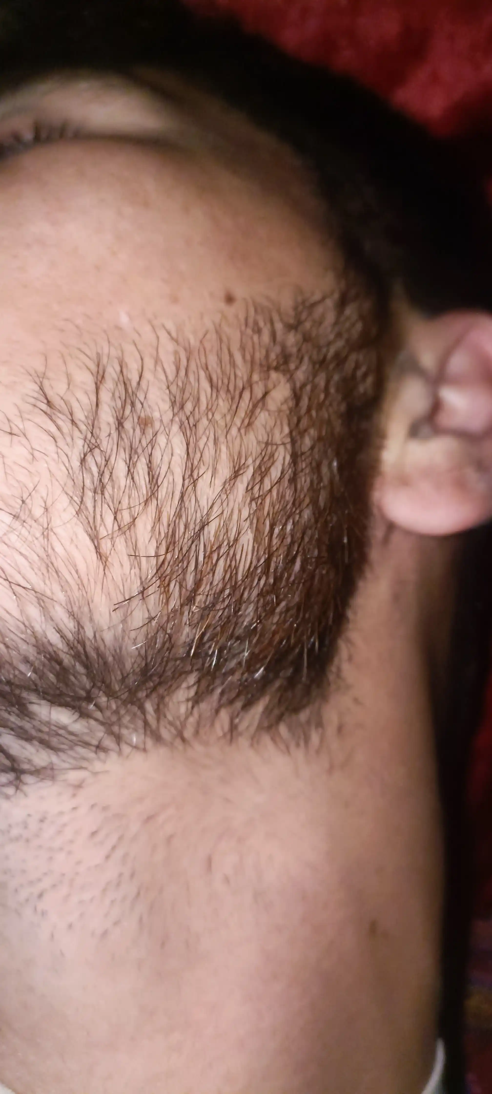Soch va soqol o'stirish uchun minoksidil Kirkland Minoxidil 5%, 60 ml