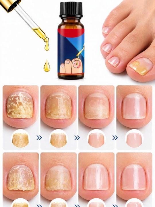Масло от грибка ногтей JAYSUING Anti Paronychia Relief Oil, 10 мл