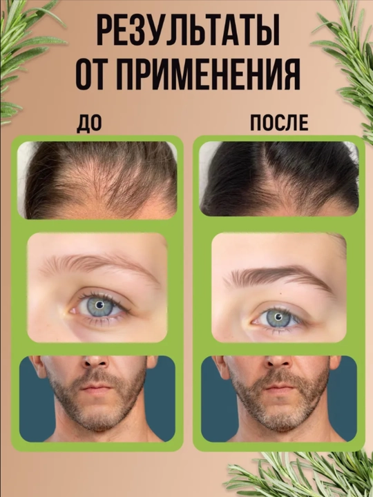 Soch va soqol o'stirish uchun rozmarin yog'i AYA, to'kilishiga qarshi serum, 30 ml