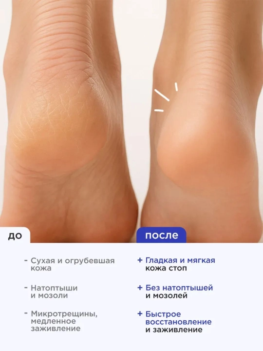 VOIS крем для ног и пяток увлажняющий питательный 500 мл