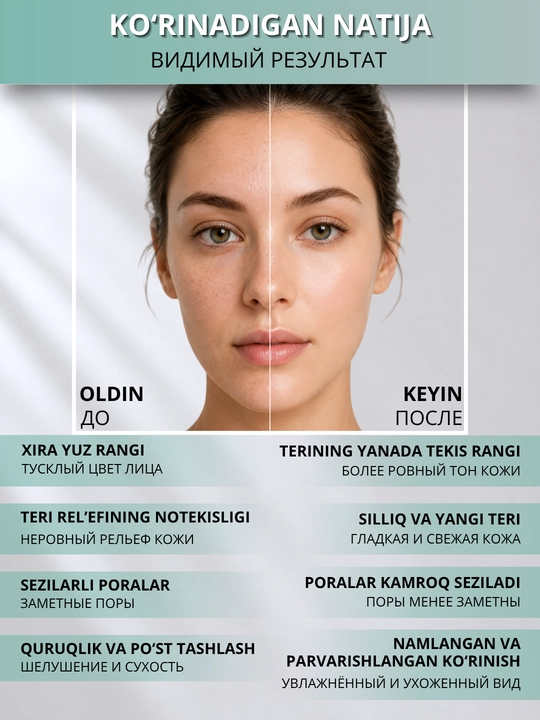 Пилинг для лица ARAVIA Professional с молочной кислотой 10% от постакне и пигментации