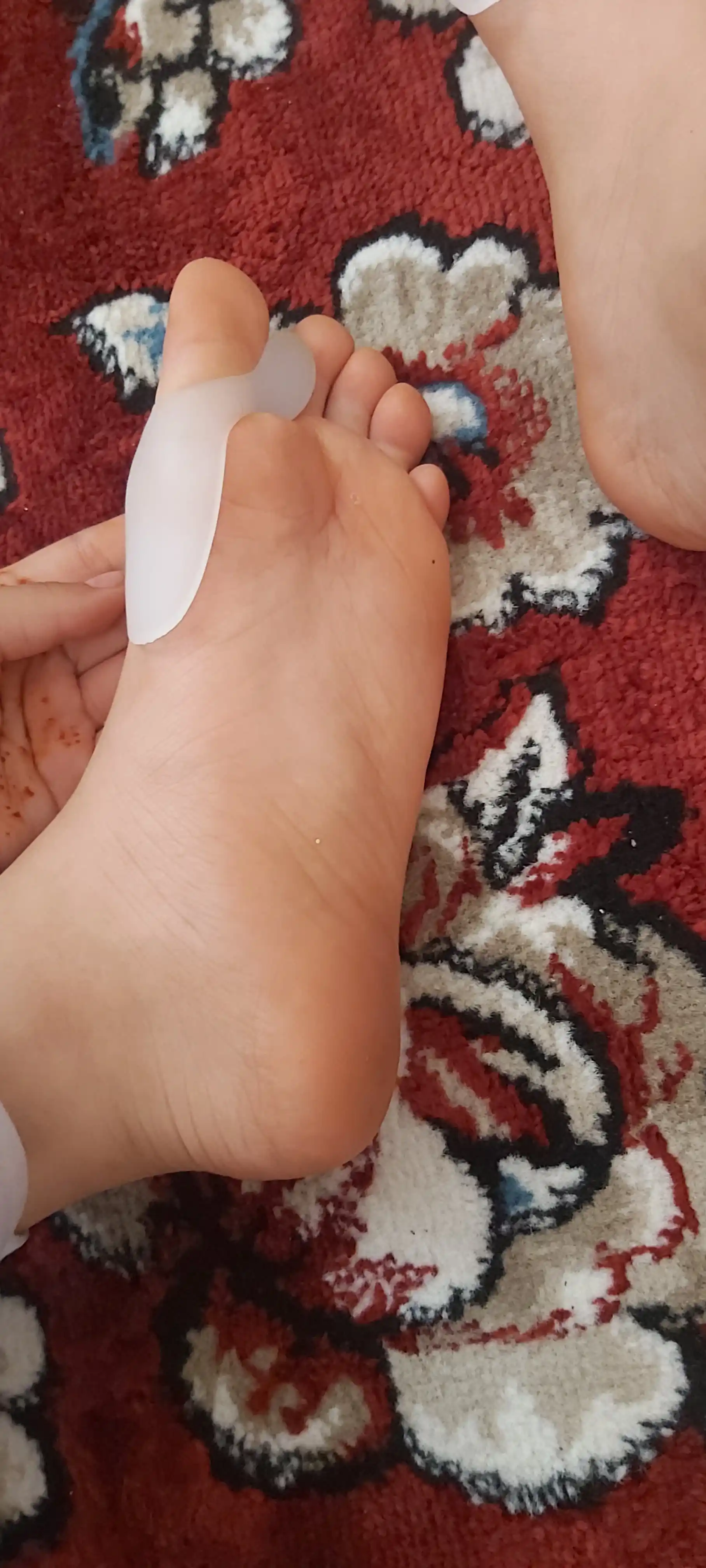 Valgus shina (kunduzgi)  – bosh barmoqni to‘g‘rilash va og‘riqni kamaytirish