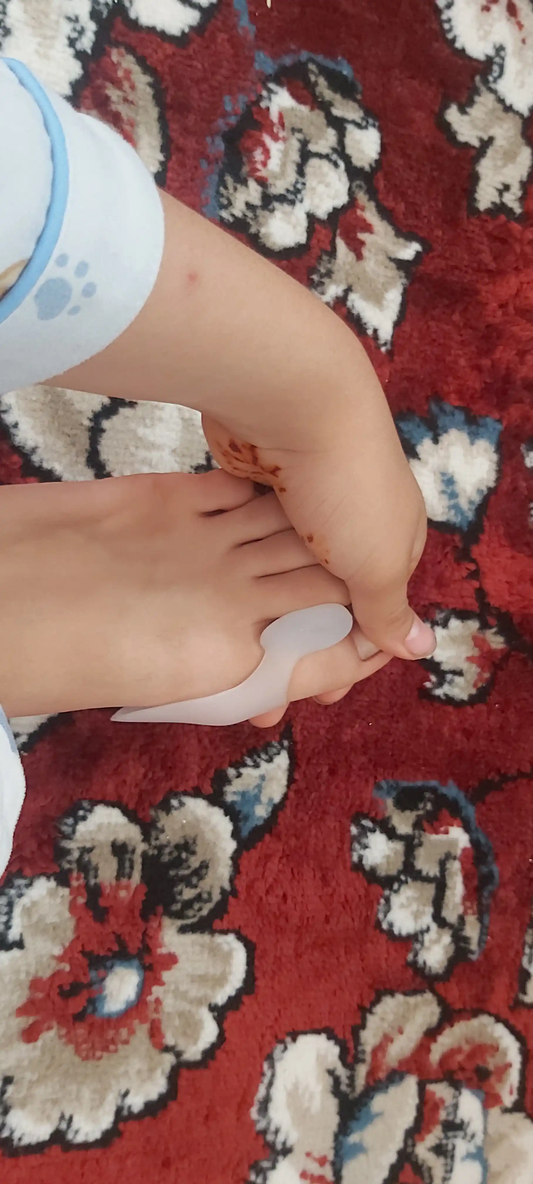 Valgus shina (kunduzgi)  – bosh barmoqni to‘g‘rilash va og‘riqni kamaytirish