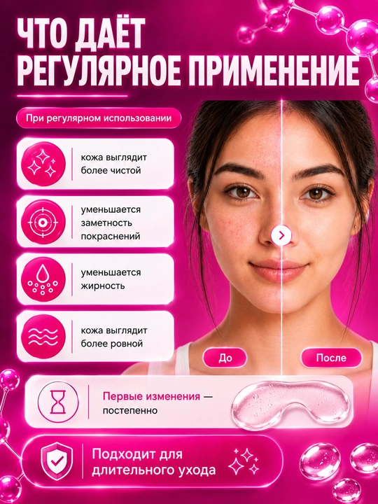 Гель от прыщей с азелаиновой кислотой 15% АЗЕЛОДЖИ, 30 г