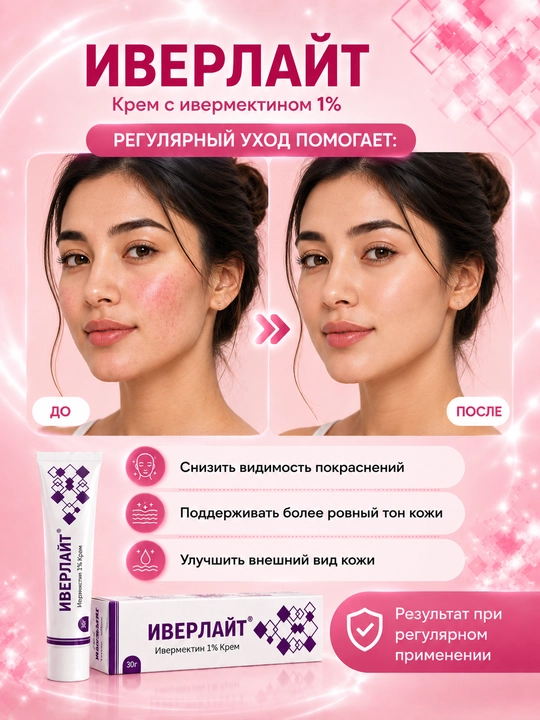 Крем ИВЕРЛАЙТ для кожи, склонной к розацеа и покраснениям, 30 г