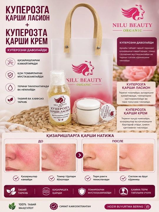 Набор для сухой кожи лица с куперозным румянцем, уход с лосьоном и кремом
