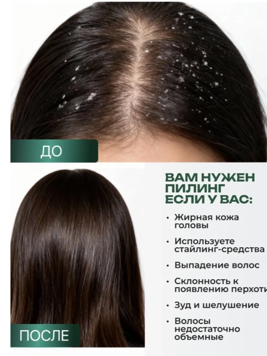 Пилинг для кожи головы, скраб для кожи головы AYA, пилинг для волос с AHA и BHA кислотами