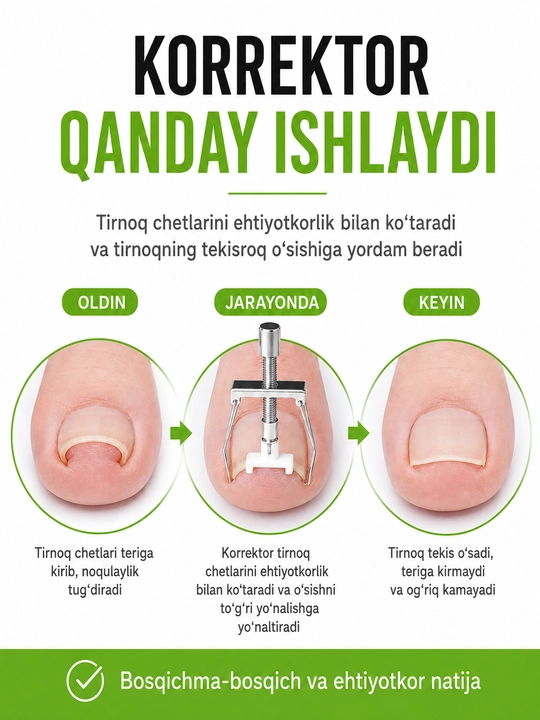 Kirib ketgan tirnoqni tuzatish uchun korrektor va qo‘shimchalar, kyuretka va yostiqchalar to‘plami