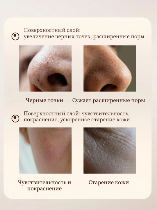 LYDIMOON Сыворотка для сужения пор с лактобионовой кислотой, 30 мл, сыворотка для лица