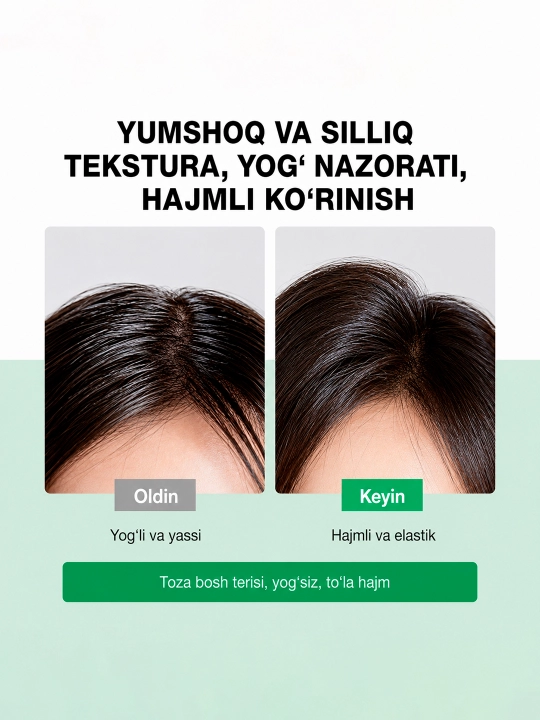 SKINEVER Shampuni: 10X Aminokislotali hajm va yog'lilikka qarshi formula, 200 ml