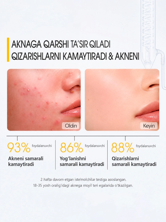 SKINEVER Akne va husnbuzarlarga qarshi tungi yuz niqobi, salitsil kislotasi bilan, 20 ml