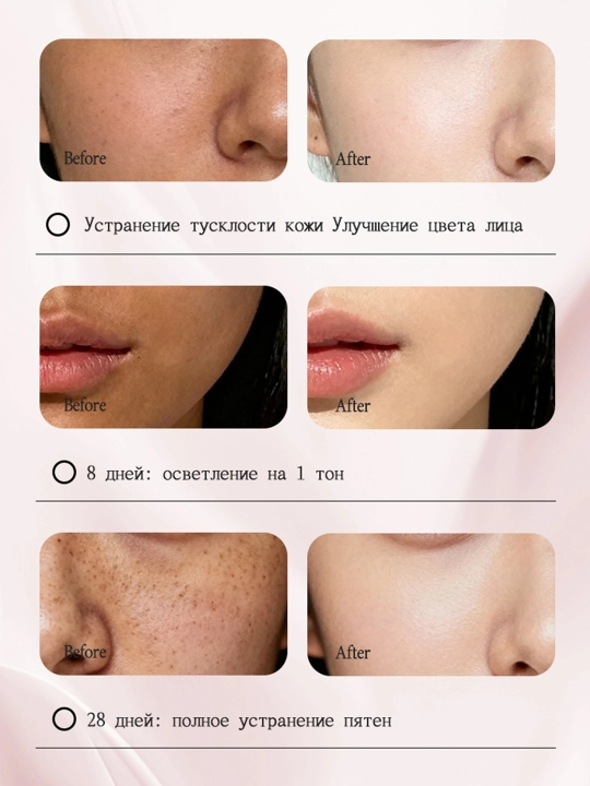 LYDIMOON sepkillarni oqartiruvchi kremi