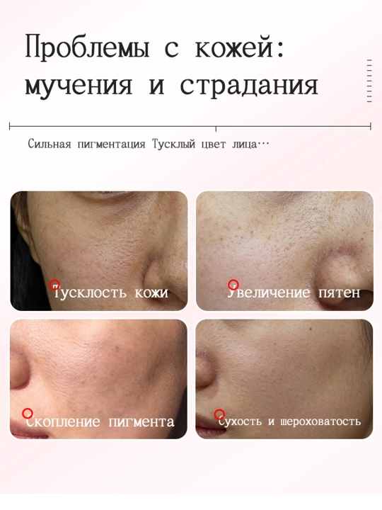 LYDIMOON sepkillarni oqartiruvchi kremi