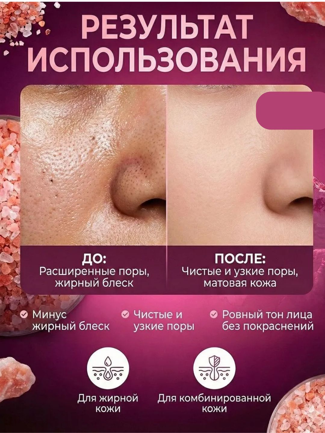 SKIN1004 Centella Travel Kit набор миниатюр — Poremizing / Tea-Trica / Hyalu-Cica,