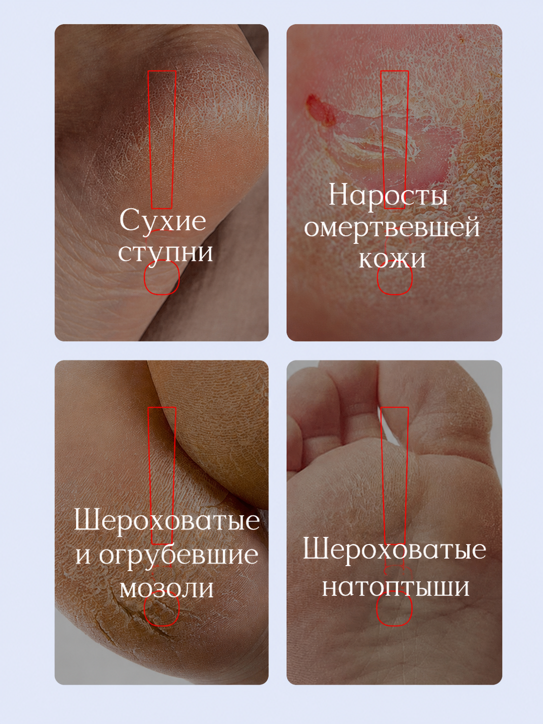 Маска-пленка для рук и ног Peel Off, отшелушивающая и увлажняющая, с ниацинамидом, 35 мл