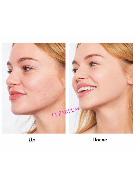 RONAS CC Color Change krem yuz uchun rangga moslashuvchi SPF 38 PA+++ tonni tekislaydi