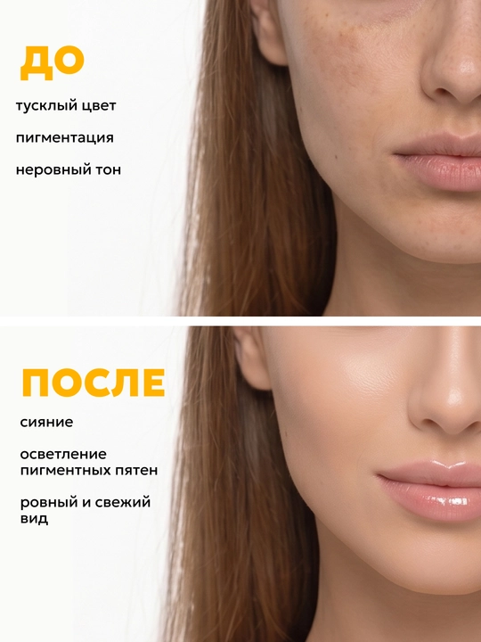 Сыворотка для лица с витамином С осветляющая Semily от пигментации, сияние, ровный тон 30 мл