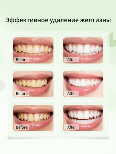 Пеноочиститель для полости рта, очищение и отбеливание, 60 мл