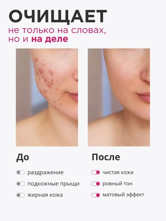 Тонер для лица против черных точек, акне и прыщей с 7% гликолевой кислотой, 250 мл