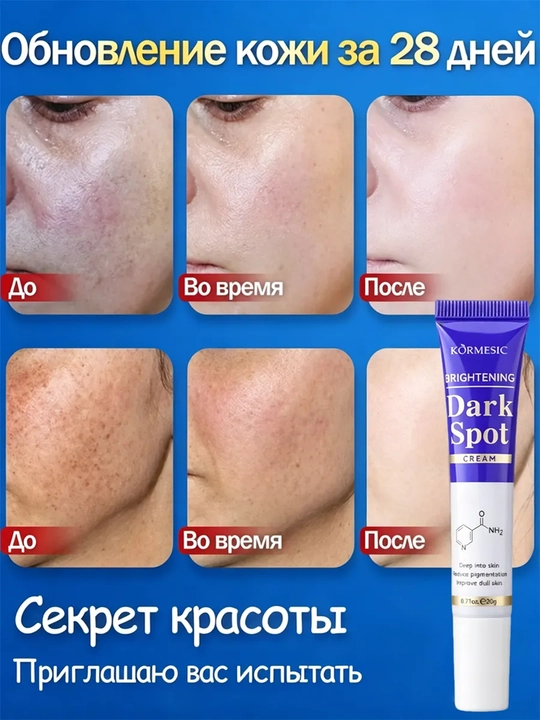 Осветляющий крем от пигментных пятен и постакне для выравнивания тона лица, 20 г