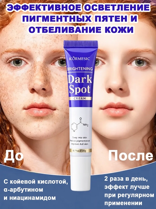 Осветляющий крем от пигментных пятен и постакне для выравнивания тона лица, 20 г - 