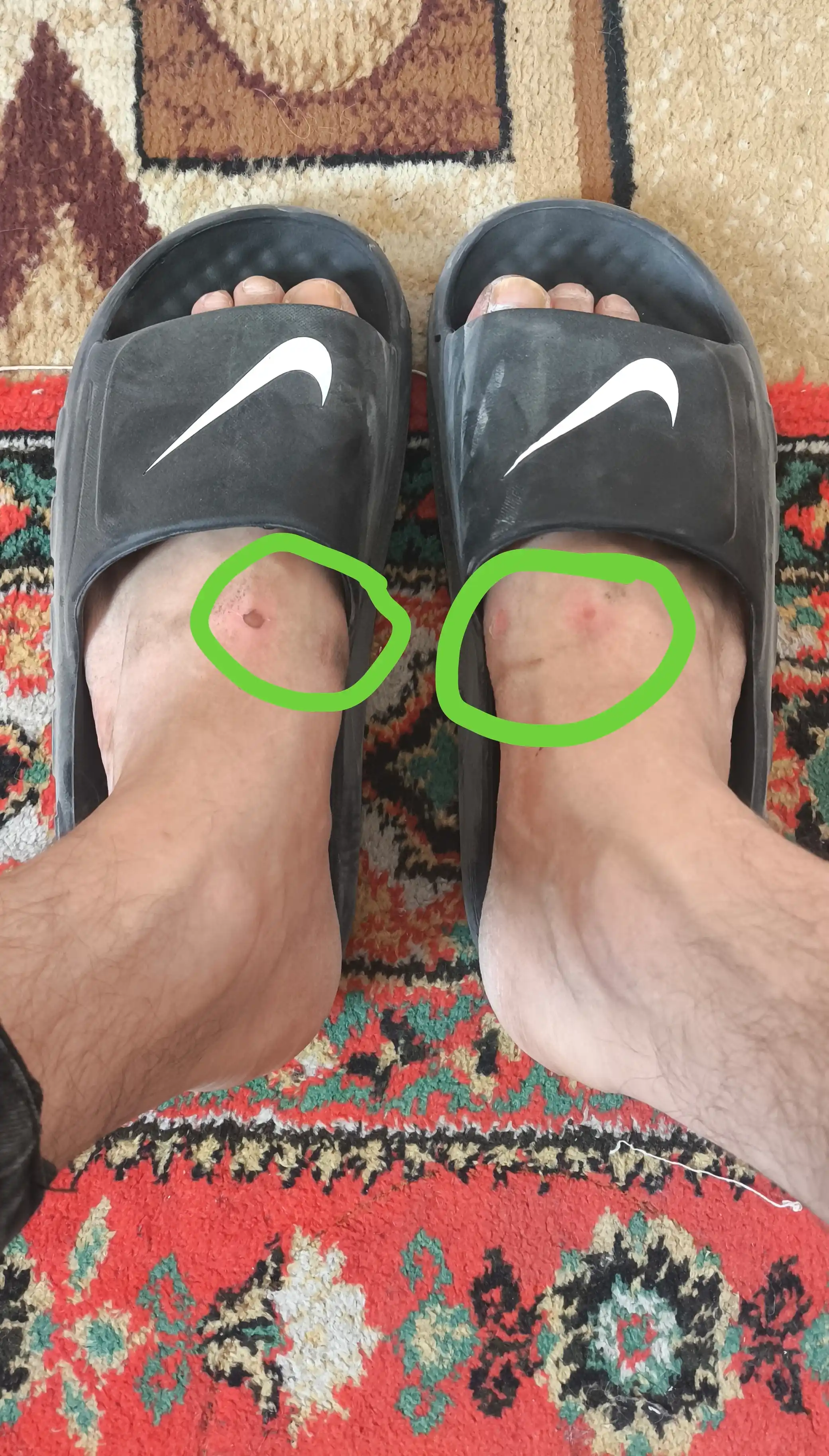 Erkaklar shippagi, yozgi poyabzal, yumshoq shifer, ko‘cha shippagi, yengil tagcharm 41-44