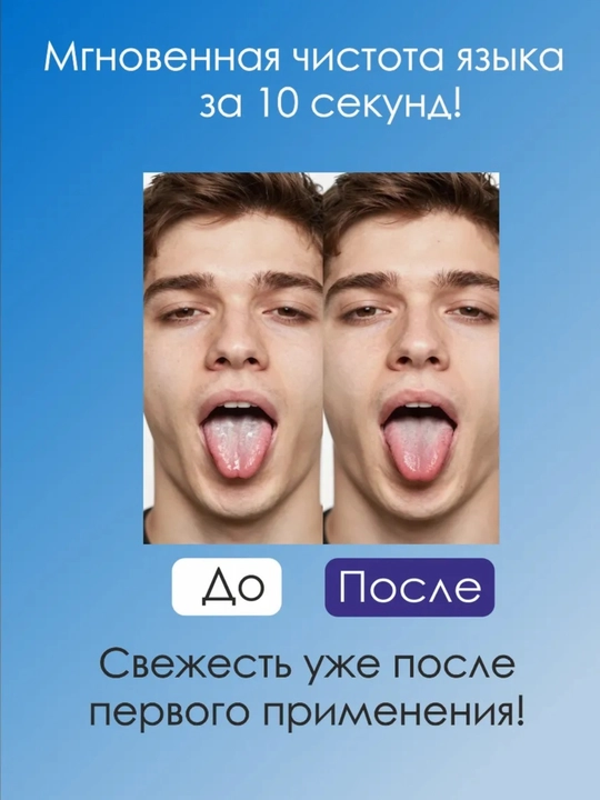 Til tozalagich, tIlni tozalash 2 tomonlama, 2 ta og‘iz bo‘shlig‘i gigiyenasi uchun to‘plam