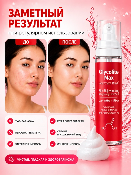 Glycolite Max akne va qora nuqtalardan yuzni yuvish uchun ko‘pik, 200 ml