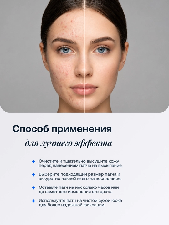 Патчи от прыщей прозрачные, маскирующие против акне