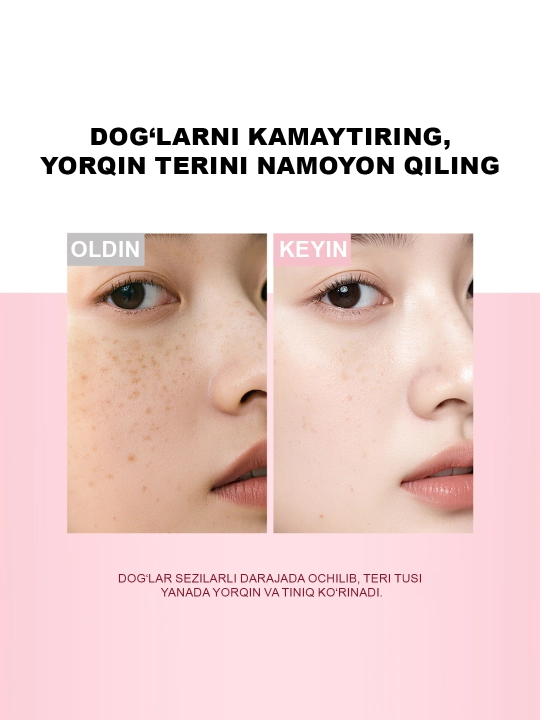 Yuz uchun oqartiruvchi SKINEVER zardobi, 10% niatsinamid bilan, pigmentatsiyaga qarshi, 30 ml