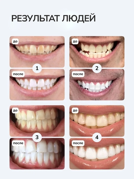 Отбеливающие полоски-патчи для зубов V34 от Hismile, полоски для отбеливания