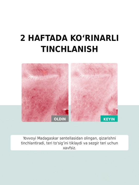 SKINEVER yuz uchun sentella, S vitamini va keramidli zardob, 30 ml