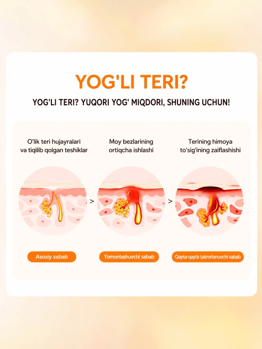 Akne va yog‘li yaltiroqlikka qarshi salitsil kislotasi qo‘shilgan SKINEVER yuz uchun po‘st tashlovchi tonik