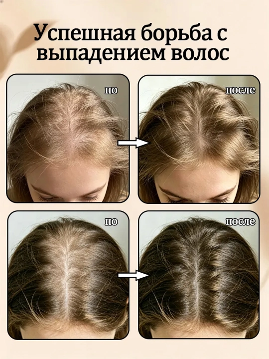 IUALLURE Шампунь для жирных и сухих волос, смягчающий и питающий волосы с имбирем