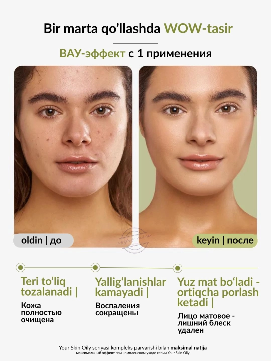 Гель для умывания лица от прыщей с ниацинамидом MIXIT Niacinamide Face Cleanser, 150 мл