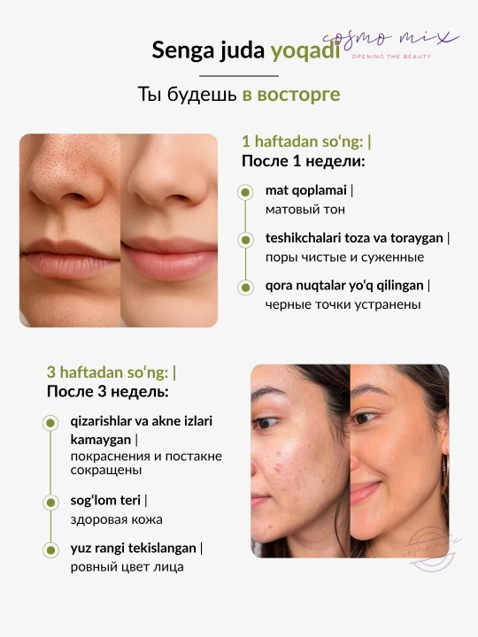 Гель для умывания лица от прыщей с ниацинамидом MIXIT Niacinamide Face Cleanser, 150 мл