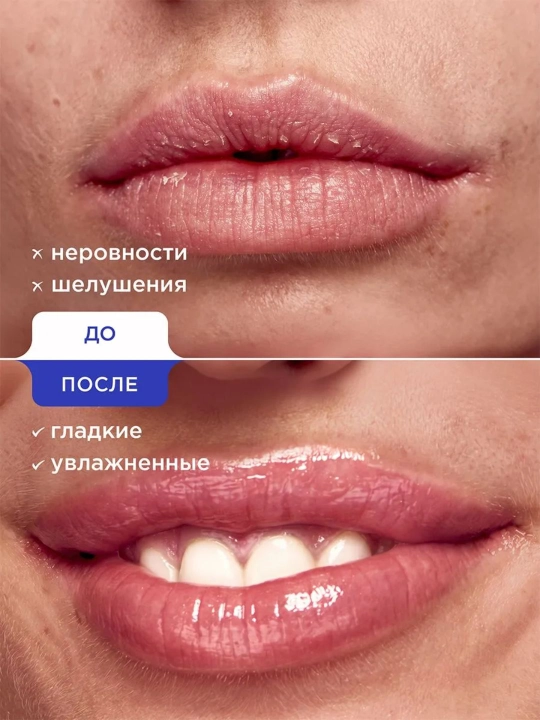 VOIS namlantiruvchi lab balzami va skrabi to‘plami, 4 dona