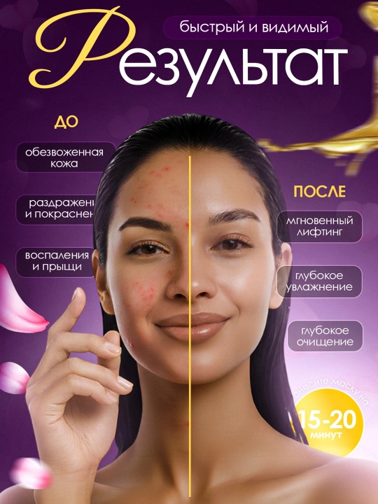 Ajinlarga qarshi va qora nuqtalarga qarshi yuz uchun plyonka niqobi GOLD MASK