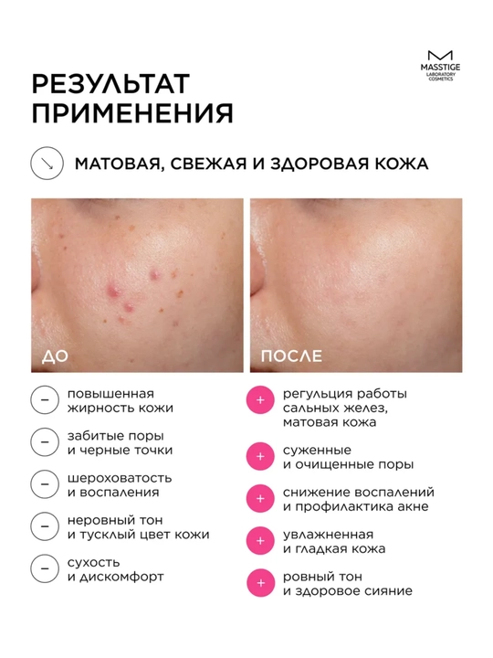 Лосьон для лица Matte Line, очищение пор, 200 мл, Masstige