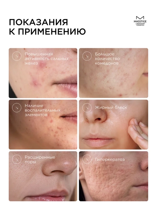 Лосьон для лица Matte Line, очищение пор, 200 мл, Masstige