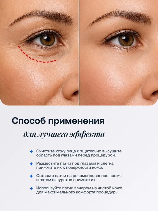 Патчи для глаз Mooyam с микроиглами, лифтинг и восстановление кожи